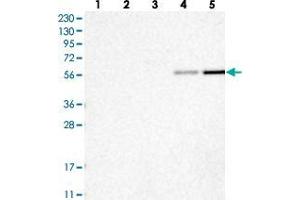 Western blot analysis of Lane 1: RT-4, Lane 2: U-251 MG, Lane 3: Human Plasma, Lane 4: Liver, Lane 5: Tonsil with RMND1 polyclonal antibody . (RMND1 anticorps)