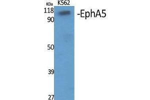 Western Blot (WB) analysis of specific cells using EphA5 Polyclonal Antibody. (EPH Receptor A5 anticorps  (Internal Region))