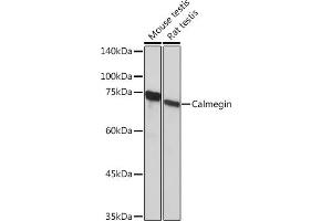 Western blot analysis of extracts of various cell lines, using Calmegin Rabbit mAb (ABIN7266026) at 1:1000 dilution. (Calmegin anticorps)