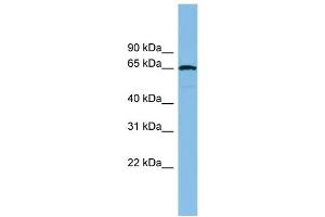 WB Suggested Anti-RAD18 Antibody Titration: 0. (RAD18 anticorps  (Middle Region))