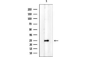 anti-5',3'-Nucleotidase, Cytosolic (NT5C) (C-Term) antibody