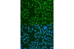 Immunofluorescence analysis of U2OS cells using KAT5 antibody. (KAT5 anticorps  (AA 1-230))