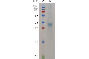 Mouse I Protein, His Tag on SDS-PAGE under reducing condition.