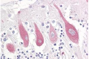 Anti-ITPR1 antibody IHC staining of human brain, cerebellum. (ITPR1 anticorps  (AA 1566-1615))