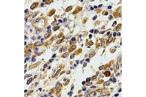 Immunohistochemical analysis of Glutaredoxin staining in human stomach formalin fixed paraffin embedded tissue section. (Glutaredoxin 1 anticorps)
