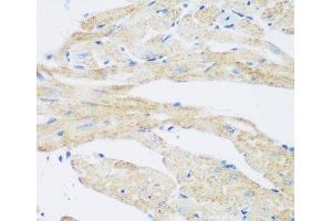 Immunohistochemistry of paraffin-embedded Mouse heart using NAT8B Polyclonal Antibody at dilution of 1:200 (40x lens). (NAT8B anticorps)