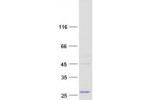Validation with Western Blot