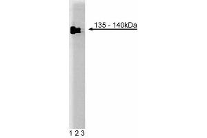 Western blot analysis of TFII-I on HeLa cell lysate. (GTF2I anticorps  (AA 17-123))