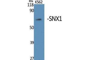 Western Blotting (WB) image for anti-Sorting Nexin 1 (SNX1) (Internal Region) antibody (ABIN3177459) (Sorting Nexin 1 anticorps  (Internal Region))