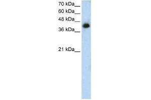 WB Suggested Anti-MTUS1 Antibody Titration: 1. (MTUS1 anticorps  (N-Term))
