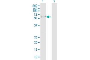Western Blot analysis of KRT16 expression in transfected 293T cell line by KRT16 MaxPab polyclonal antibody.