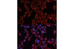 Immunofluorescence analysis of NIH/3T3 cells using  antibody (ABIN6131156, ABIN6136521, ABIN6136522 and ABIN6223942) at dilution of 1:100.