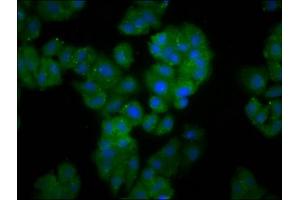 Immunofluorescence staining of HepG2 cells with ABIN7152402 at 1:166, counter-stained with DAPI.