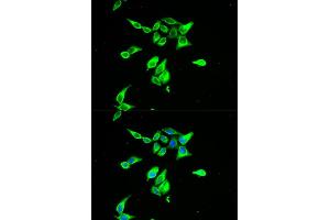 Immunofluorescence analysis of A549 cells using CD55 antibody (ABIN5970570). (CD55 anticorps)