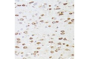 Immunohistochemistry of paraffin-embedded rat brain using ARHGAP5 antibody. (ARHGAP5 anticorps  (AA 1292-1501))