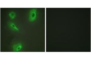 Immunofluorescence (IF) image for anti-Branched Chain Ketoacid Dehydrogenase Kinase (BCKDK) (AA 11-60) antibody (ABIN2889312) (BCKDK anticorps  (AA 11-60))