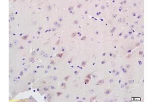 Formalin-fixed and paraffin embedded rat brain labeled with Anti-ADAMTS7 Polyclonal Antibody, Unconjugated (ABIN672486) at 1:200 followed by conjugation to the secondary antibody and DAB staining. (ADAMTS7 anticorps  (AA 241-340))