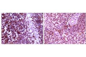Immunohistochemical analysis of paraffin-embedded human thymoma tissue (left) and spleen tissue (right), showing cytoplasmic localization using MAP2K4 mouse mAb with DAB staining.