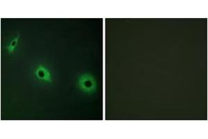 Immunofluorescence analysis of HepG2 cells, using CELSR3 Antibody. (CELSR3 anticorps  (AA 91-140))