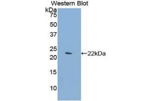 Western Blotting (WB) image for anti-C-Type Lectin Domain Family 4, Member M (CLEC4M) (AA 242-399) antibody (ABIN1858422)