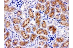 IHC testing of FFPE rat kidney with CYP24A1 antibody. (CYP24A1 anticorps  (AA 153-514))