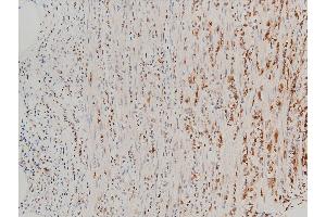 ABIN6267443 at 1/100 staining rat appendiceal tissue sections by IHC-P.