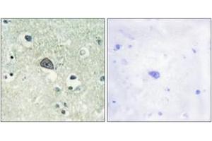 Immunohistochemistry analysis of paraffin-embedded human brain, using NMDAR1 (Phospho-Ser890) Antibody. (GRIN1/NMDAR1 anticorps  (pSer890))