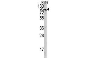 Western blot analysis of ACE2 polyclonal antibody  in K-562 cell lysate (35 ug/lane). (ACE2 anticorps  (AA 773-805))
