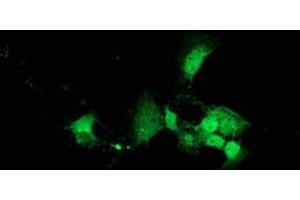 Image no. 1 for anti-DnaJ (Hsp40) Homolog, Subfamily B, Member 2 (DNAJB2) antibody (ABIN1497868) (DNAJB2 anticorps)