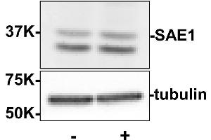 Western blot using  Rabbit anti-SAE1 antibody shows detection of SAE1. (SAE1 anticorps  (Internal Region))