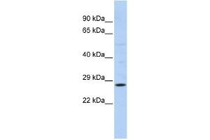RAB38 antibody used at 1 ug/ml to detect target protein. (RAB38 anticorps  (N-Term))
