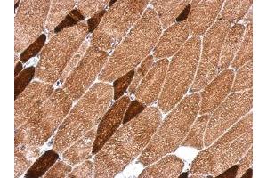 Image no. 1 for anti-3-Oxoacyl-ACP Synthase, Mitochondrial (OXSM) (AA 1-236) antibody (ABIN1501900)