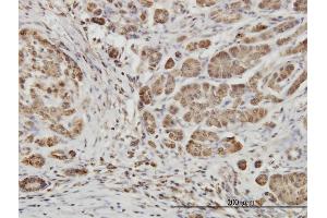 Immunoperoxidase of monoclonal antibody to EPHB6 on formalin-fixed paraffin-embedded human pancreas.