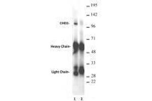 CHD3 antibody (rAb) tested antibody tested by immunoprecipitation. (Recombinant CHD3 anticorps  (AA 865-885))