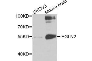 Western blot analysis of extracts of various cell lines, using EGLN2 antibody (ABIN5971259) at 1/1000 dilution. (PHD1 anticorps)