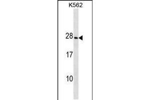 Western blot analysis in K562 cell line lysates (35ug/lane). (CRYGD anticorps  (AA 73-101))