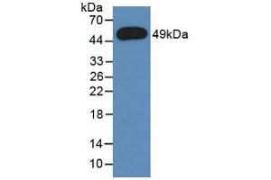 Western blot analysis of recombinant Rat a1AGP. (ORM1 anticorps  (AA 19-186))