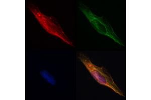 ABIN6261605 and ABIN6268755 staining Hela by IF/ICC. (EpCAM anticorps  (Internal Region))