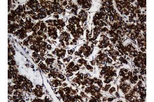 Image no. 3 for anti-NADH Dehydrogenase (Ubiquinone) 1 beta Subcomplex, 10, 22kDa (NDUFB10) antibody (ABIN1499672) (NDUFB10 anticorps)