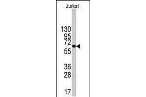 Western blot analysis of anti-PFKFB1 Antibody in Jurkat cell line lysates (35ug/lane). (PFKFB1 anticorps  (AA 259-289))