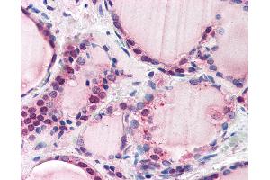 Anti-FBXL3 antibody IHC of human thyroid. (FBXL3 anticorps  (AA 2-15))
