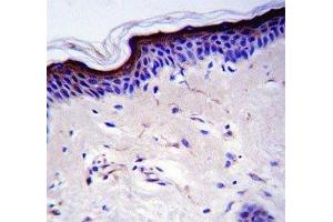 TP53 antibody immunohistochemistry analysis in formalin fixed and paraffin embedded human skin tissue.