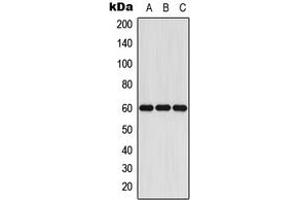 Western blot analysis of Cytochrome P450 11A1 expression in Jurkat (A), mouse liver (B), rat liver (C) whole cell lysates. (CYP11A1 anticorps  (C-Term))