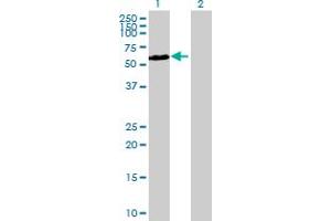 Western Blot analysis of CDKL3 expression in transfected 293T cell line by CDKL3 MaxPab polyclonal antibody. (CDKL3 anticorps  (AA 1-592))