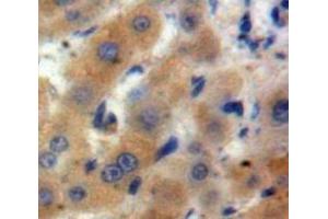 Used in DAB staining on fromalin fixed paraffin-embedded Liver tissue