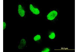 Immunofluorescence of monoclonal antibody to HDAC4 on HeLa cell.