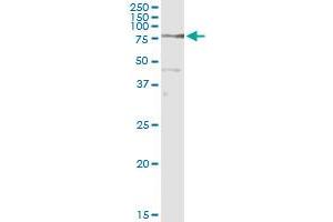 Immunoprecipitation of COIL transfected lysate using anti-COIL MaxPab rabbit polyclonal antibody and Protein A Magnetic Bead , and immunoblotted with COIL purified MaxPab mouse polyclonal antibody (B01P) .