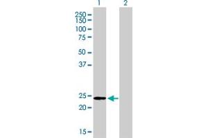 Western Blot analysis of AK1 expression in transfected 293T cell line by AK1 monoclonal antibody (M06), clone 3A6-1F5.