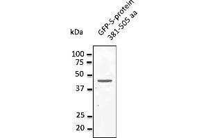 Western Blotting (WB) image for anti-MERS-Coronavirus Spike Protein (MERS-CoV S) (AA 381-505) antibody (ABIN6254147) (MERS-Coronavirus Spike anticorps  (AA 381-505))