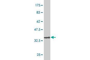 Western Blot detection against Immunogen (36. (TFDP3 anticorps  (AA 1-100))